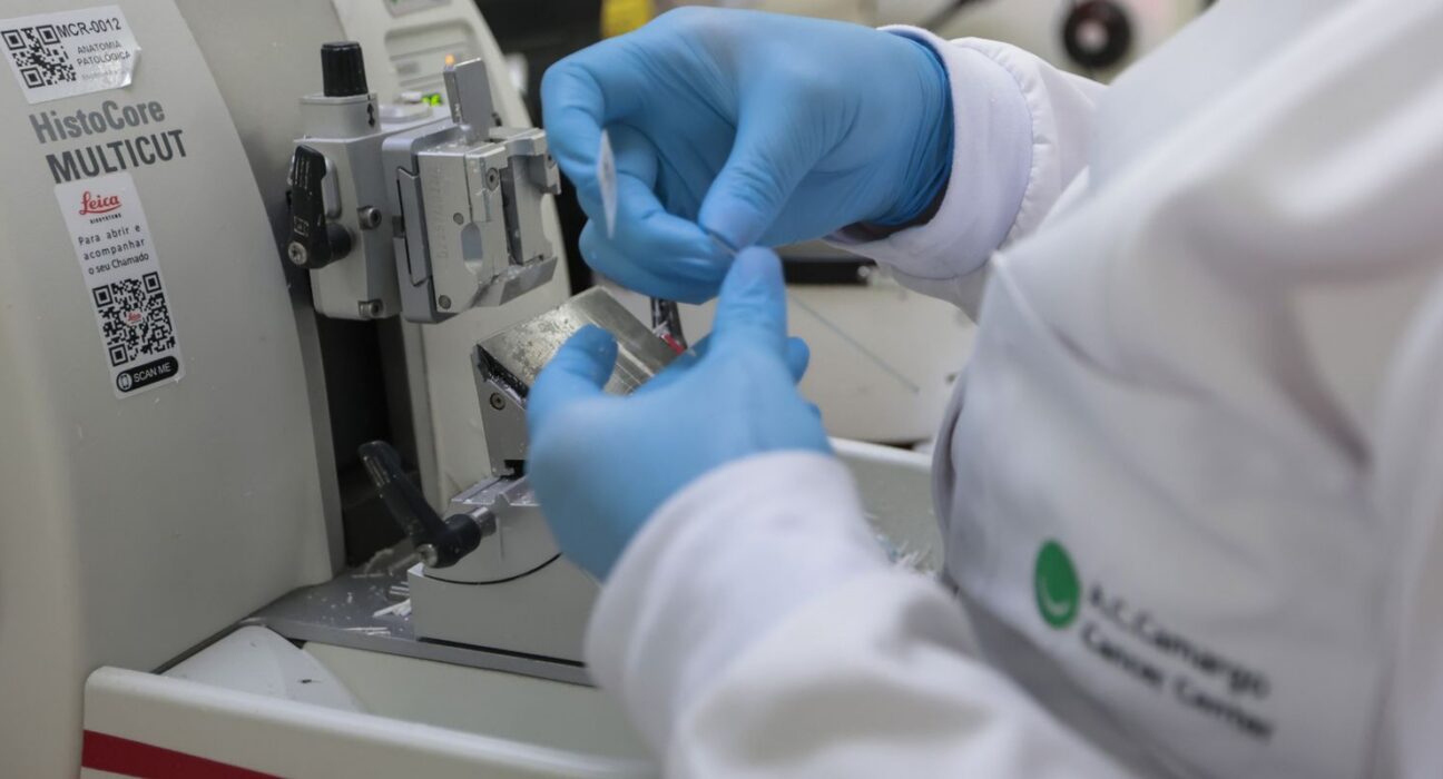 Cura de câncer de próstata pode chegar a até 98%