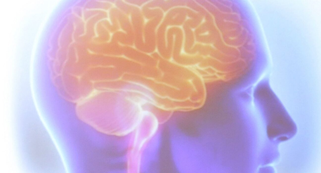 Projeto Ártemis avalia genética de pacientes que sofreram AVC