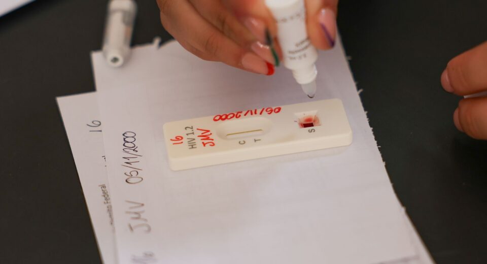Ação no DF oferece testagem rápida e informação sobre HIV/Aids