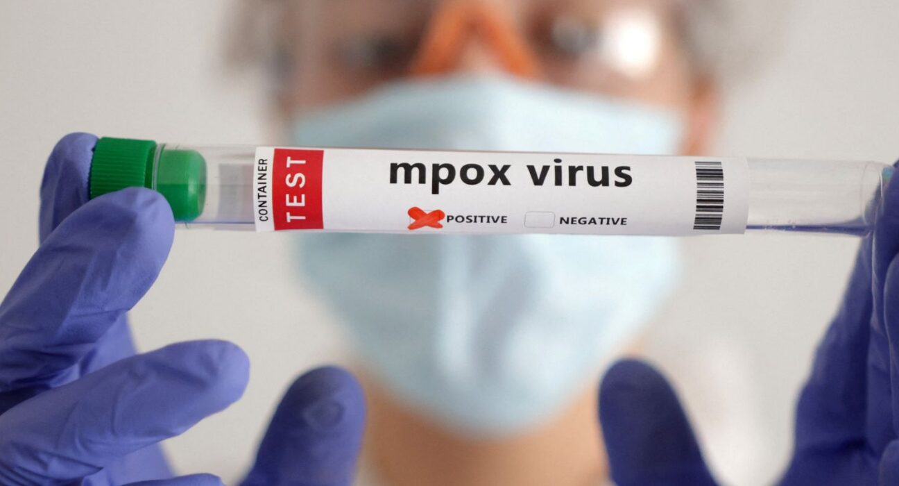 Secretaria de Saúde confirma segundo caso de mpox do grupo lp em SP