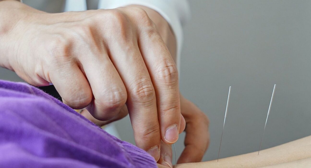 Brasil regulamenta exercício profissional da acupuntura