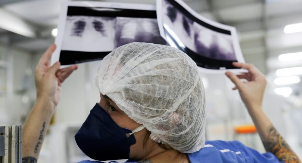 Brasil deve ter 781 mil novos casos de câncer por ano até 2028