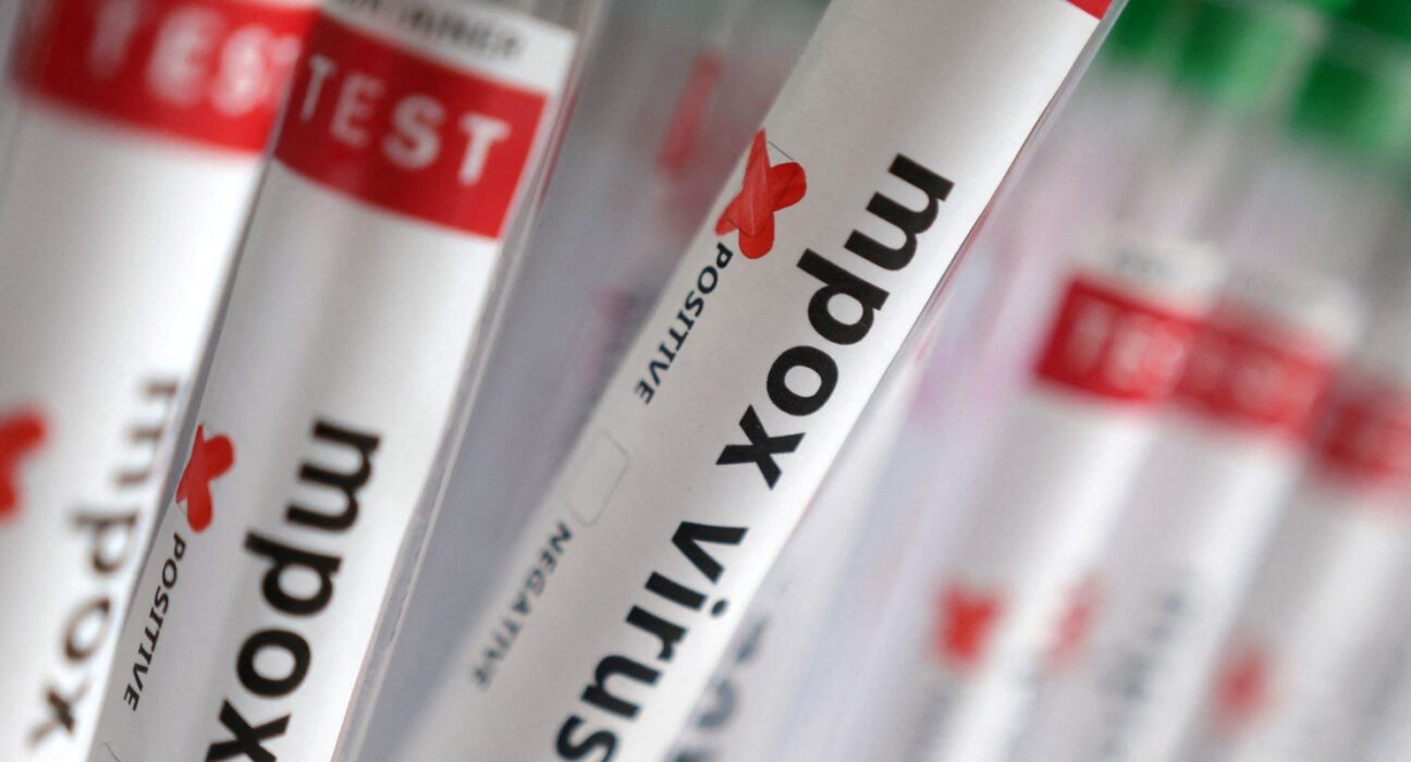 Sobe para 140 número de casos confirmados de Mpox no país, em 2026