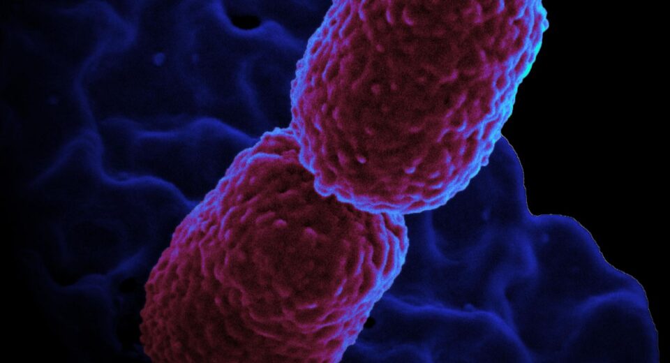 Hospital em Campinas restringe atendimento para conter superbactéria