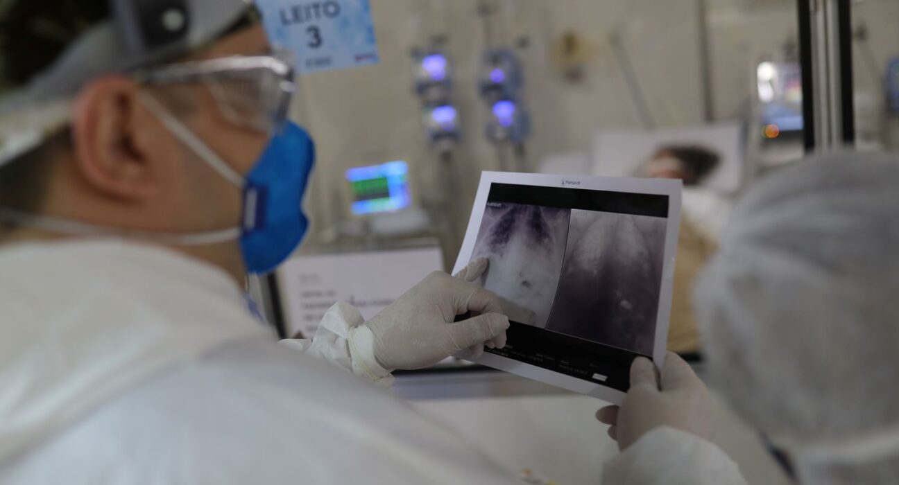 Broncopneumonia: entenda quadro que causou internação de Bolsonaro