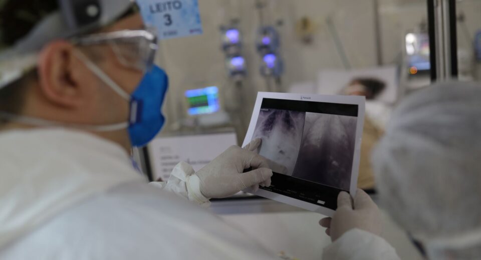 Broncopneumonia: entenda quadro que causou internação de Bolsonaro