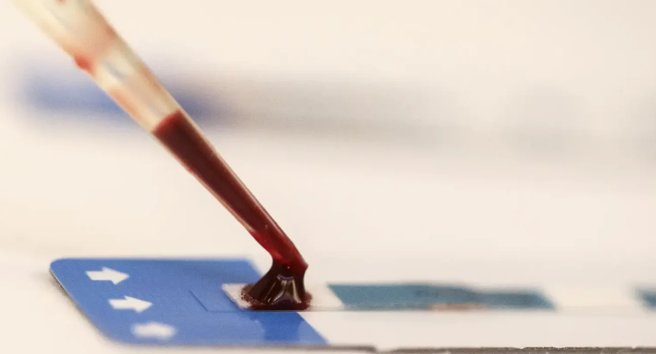 Estudo inédito da Fiocruz pode ampliar prevenção de HIV entre jovens