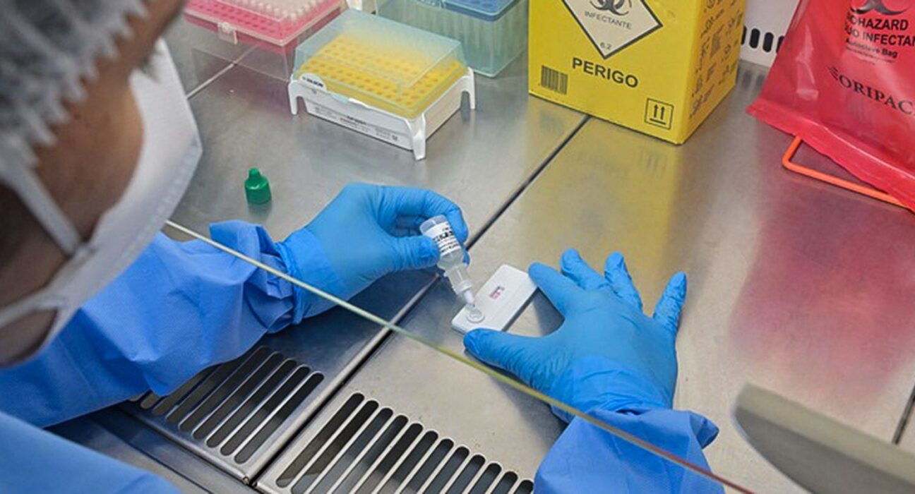 Anvisa atualiza regras sobre controle de qualidade em laboratórios