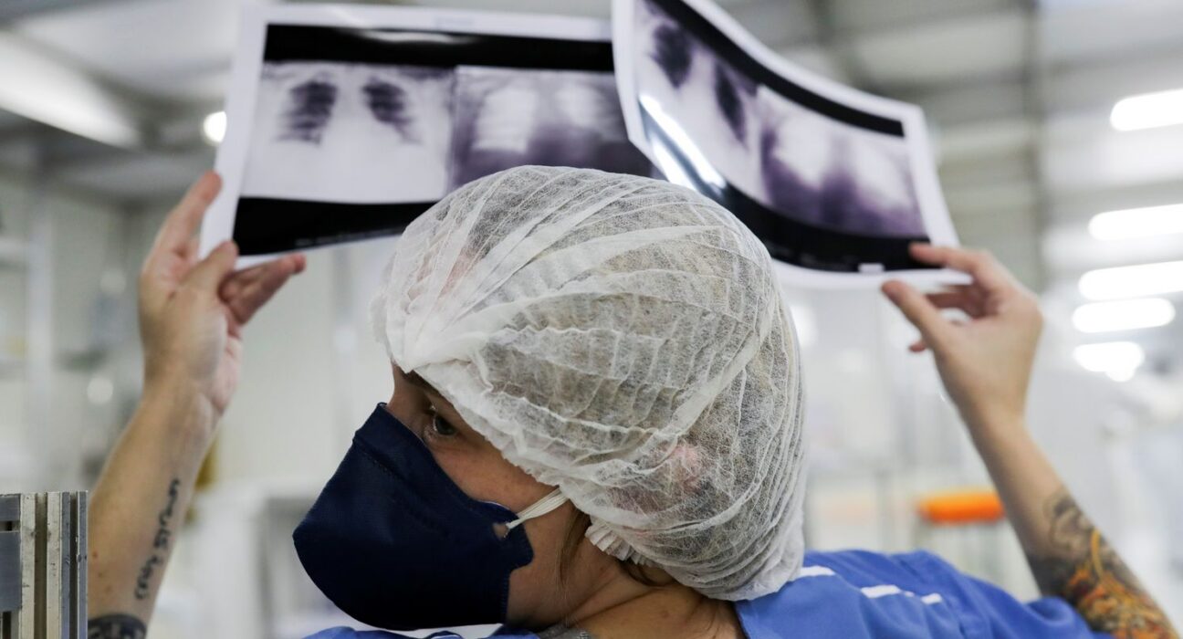 Diagnóstico tardio dá poucas chances de cura para o câncer de pulmão