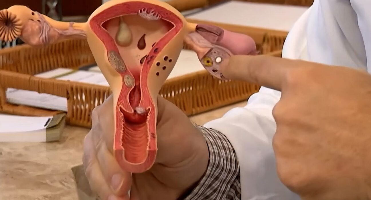 Aberta chamada pública para pesquisas sobre endometriose