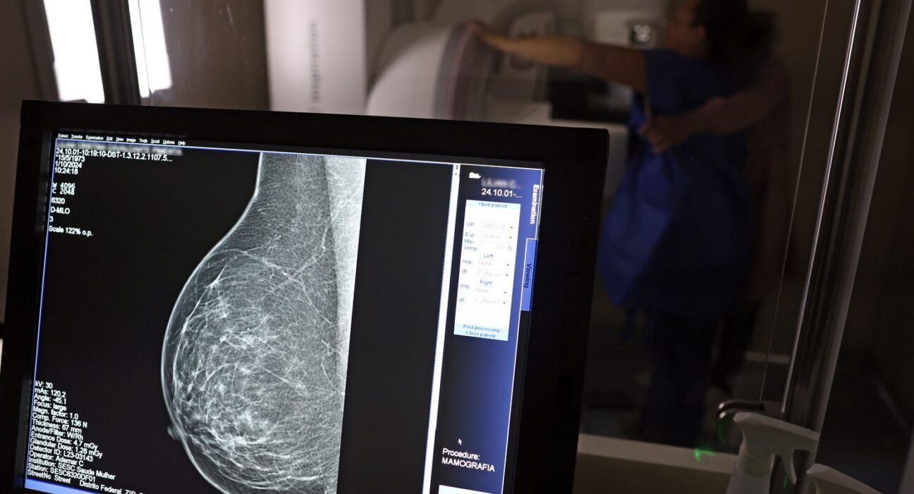 Plano de saúde terá que cobrir mamografia digital para todas as idades