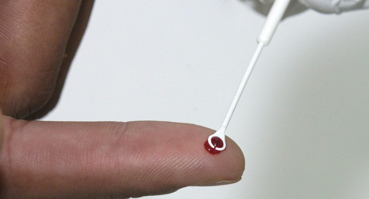 Fiji declara emergência nacional por HIV com 1 caso a cada 60 pessoas